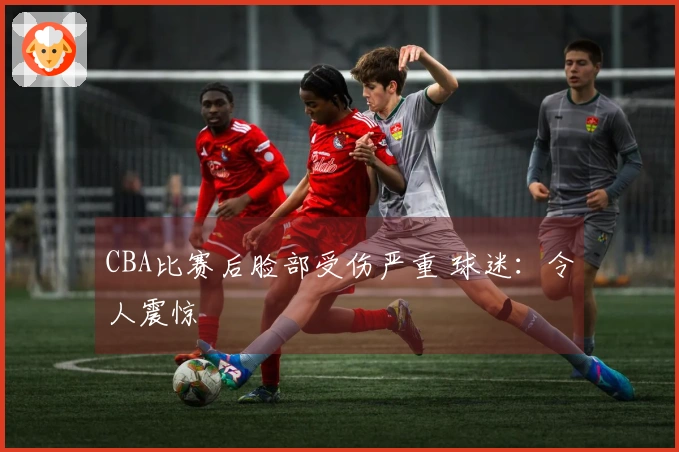 CBA比赛后脸部受伤严重 球迷：令人震惊